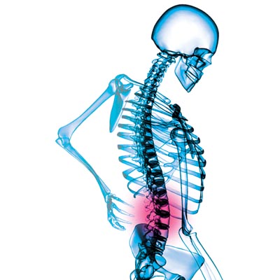 back pain in Dronfield, Chesterfield, Sheffield